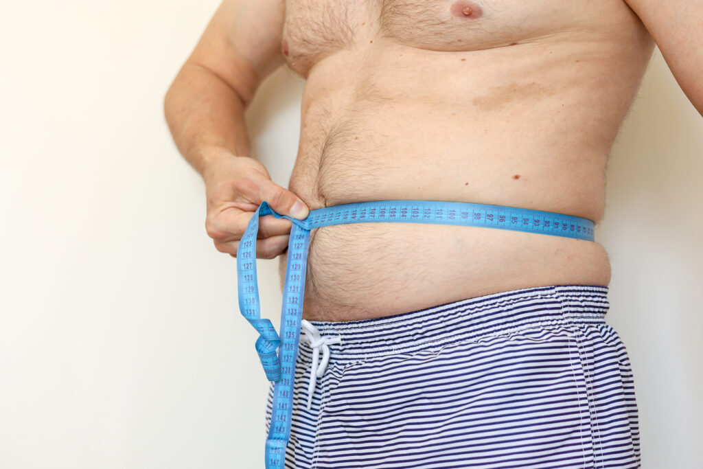 Mini gastric bypass vs gastric sleeve comparison - man measuring belly before weight loss surgery