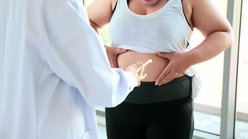 Does insurance cover bariatric surgery - patient at hospital consultation for weight loss procedure