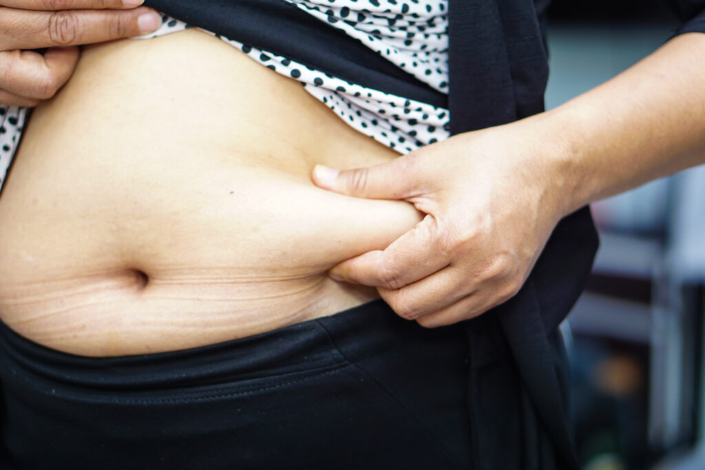 Bariatric surgery for type 2 diabetes - patient considering weight loss surgery for health improvement