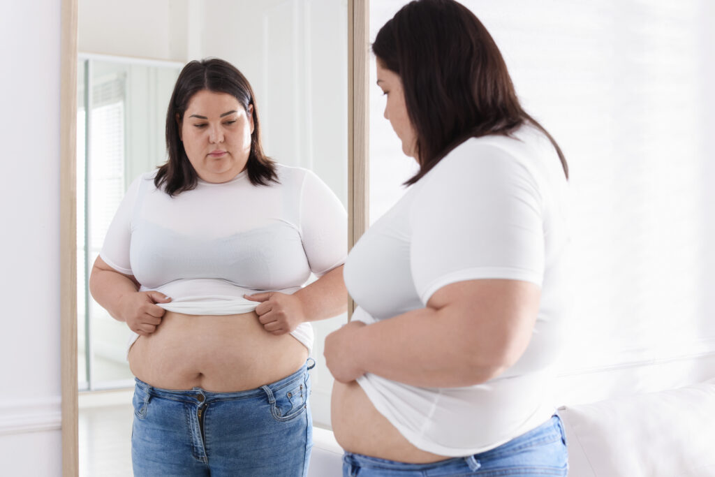 Loose skin after weight loss surgery - woman checking body transformation progress in mirror