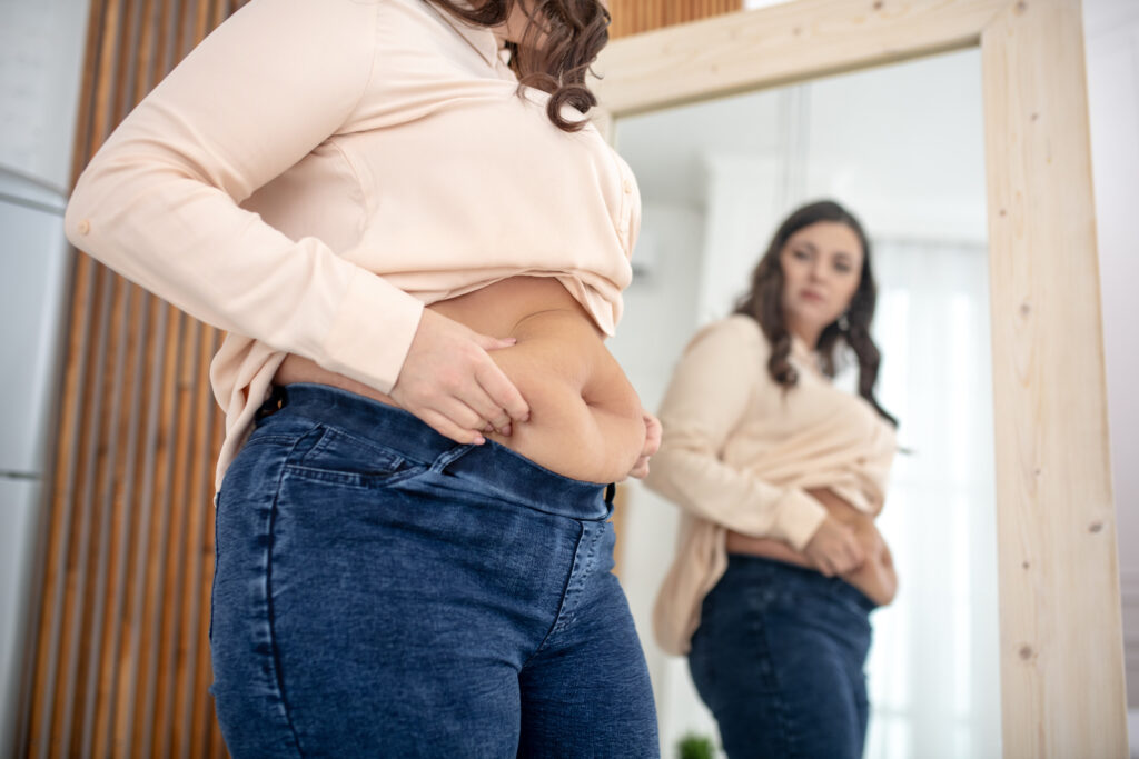 Hair loss after bariatric surgery - woman examining body after weight loss surgery recovery