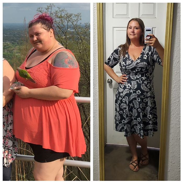 Breast lift and augmentation results